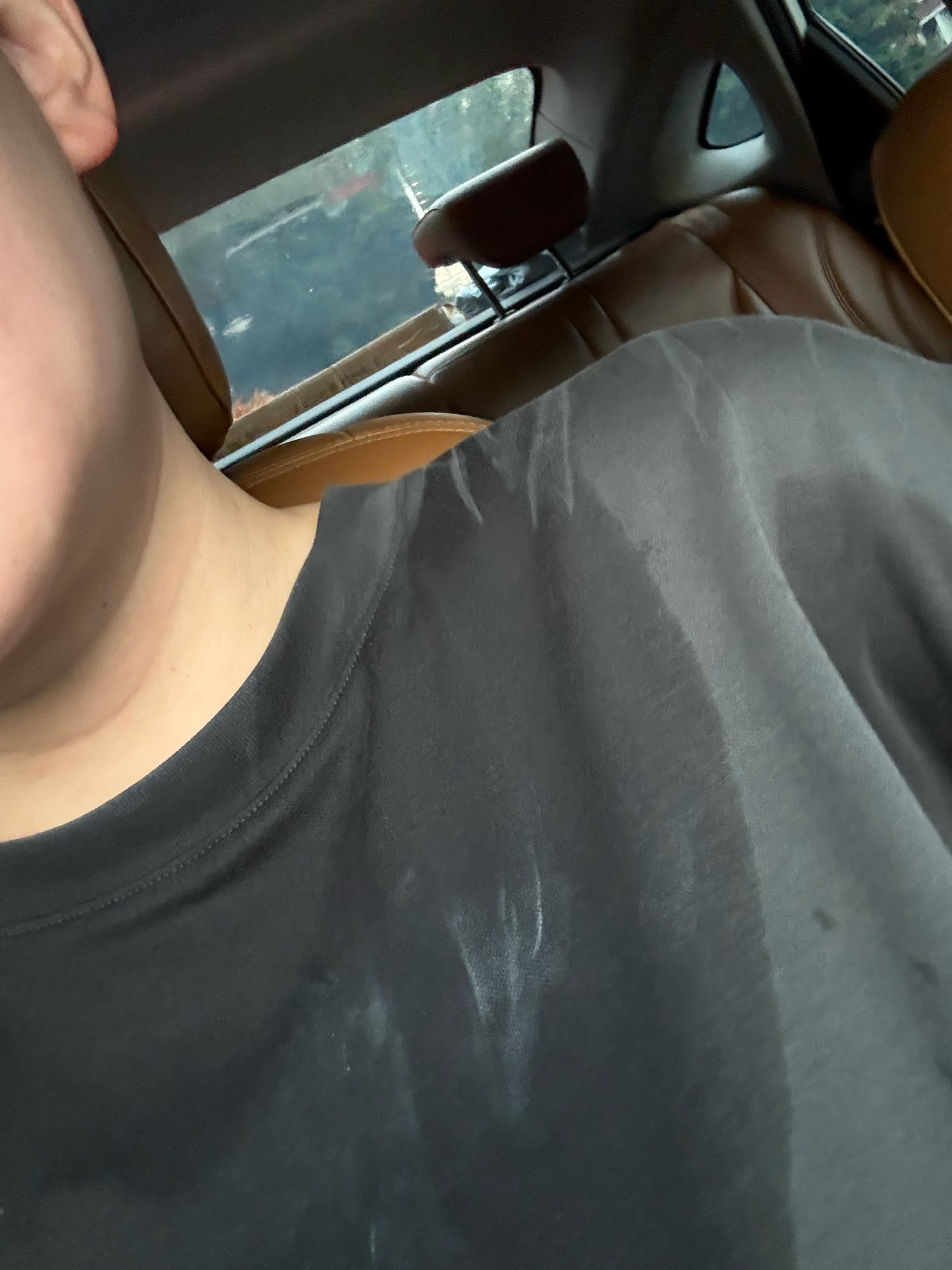 这直接导致 这直接导致